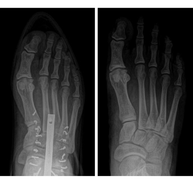 The Tale Of Two Feet By Podiatrist Dr Jeff Merrill Klamath Falls